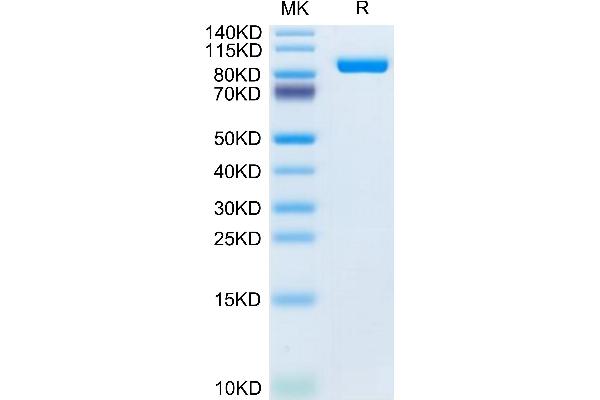 Lrig1 Protein (AA 35-794) (His tag)