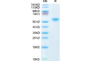Human CD28H on Tris-Bis PAGE under reduced condition. (CD28H (AA 23-150) protein (Fc Tag))
