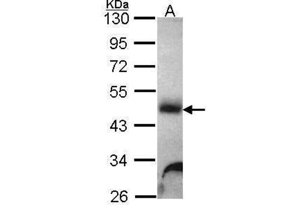 GLA antibody