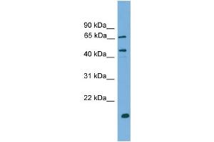 WB Suggested Anti-DNAJA2 Antibody Titration: 0. (DNAJA2 antibody  (N-Term))