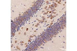 Immunohistochemistry analysis of paraffin-embedded mouse testis using TESK1 (ABIN7075866)at dilution of 1: 500 (TESK1 antibody)