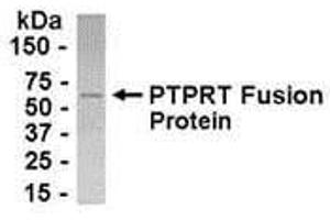 Western Blotting (WB) image for anti-Protein tyrosine Phosphatase, Non-Receptor Type 1 (PTPN1) (AA 288-364) antibody (ABIN2468000) (PTPN1 antibody  (AA 288-364))