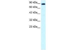 KIF21A antibody used at 0. (KIF21A antibody  (N-Term))