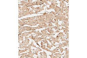 Immunohistochemical analysis of paraffin-embedded Human heart tissue using A performed on the Leica® BOND RXm. (COL5A1 antibody  (N-Term))