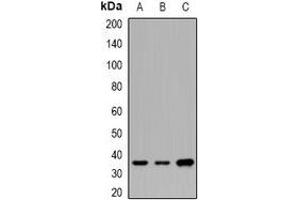 Western blot analysis of CNTFR alpha expression in SW620 (A), BT474 (B), mouse brain (C) whole cell lysates. (CNTF Receptor alpha antibody)