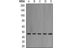Western blot analysis of eIF4A1 expression in Hela (A), Jurkat (B), NIH3T3 (C), PC12 (D), mouse liver (E) whole cell lysates. (EIF4A1 antibody)
