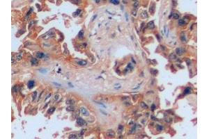 Immunohistochemistry (IHC) image for anti-Intercellular Adhesion Molecule 1 (ICAM1) (AA 41-464) antibody (ABIN7431971)
