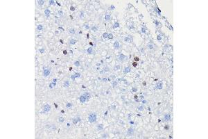 Immunohistochemistry (IHC) image for anti-Cyclin D1 (CCND1) antibody (ABIN7266561)