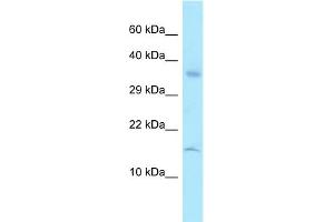 WB Suggested Anti-RPL36A Antibody Titration: 1. (RPL36A antibody  (Middle Region))