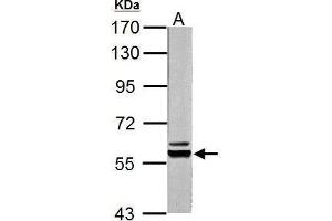 WB Image Pyruvate Kinase (liver/RBC) antibody detects Pyruvate Kinase (liver/RBC) protein by Western blot analysis.