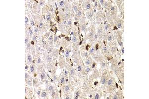 Immunohistochemistry of paraffin-embedded human liver injury using SPN antibody. (CD43 antibody  (AA 276-400))