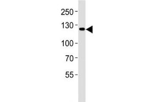 Western Blotting (WB) image for anti-Janus Kinase 2 (JAK2) (C-Term) antibody (ABIN3031510)