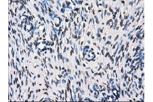 Immunohistochemical staining of paraffin-embedded Kidney tissue using anti-TTLL12mouse monoclonal antibody. (TTLL12 antibody)