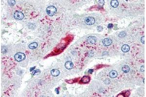 Human Liver, Kupffer Cells (formalin-fixed, paraffin-embedded) stained with CD74 antibody ABIN239807 at 10 µg/ml followed by biotinylated anti-mouse IgG secondary antibody ABIN481714, alkaline phosphatase-streptavidin and chromogen. (CD74 antibody)