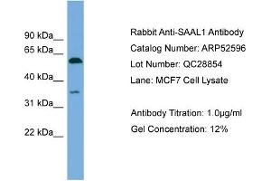 WB Suggested Anti-SAAL1  Antibody Titration: 0. (SAAL1 antibody  (N-Term))