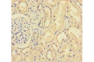 Immunohistochemistry of paraffin-embedded human kidney tissue using ABIN7151314 at dilution of 1:100 (XIAP antibody  (AA 1-497))