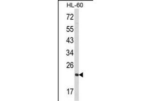 Western blot analysis of RAN Antibody (N-term) (ABIN390647 and ABIN2840945) in HL-60 cell line lysates (35 μg/lane). (RAN antibody  (N-Term))