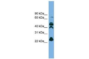 RPE antibody used at 1 ug/ml to detect target protein. (RPE antibody  (N-Term))