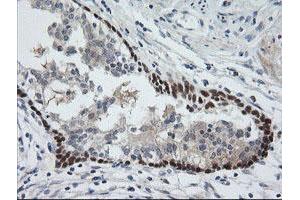 Image no. 7 for anti-Chromosome 2 Open Reading Frame 62 (C2orf62) antibody (ABIN1497053) (C2orf62 antibody)