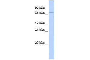 WB Suggested Anti-RBM35B Antibody Titration:  0.