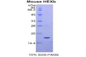 SDS-PAGE (SDS) image for Hexosaminidase B (Beta Polypeptide) (HEXB) (AA 101-217) protein (His tag) (ABIN2121242) (HEXB Protein (AA 101-217) (His tag))