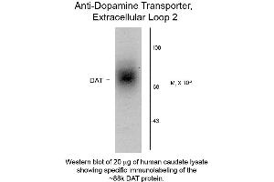 Western Blot of Anti-Dopamine Transporter (Rabbit) Antibody - 600-401-D30 Western Blot of Rabbit Anti-Dopamine Transporter C-Terminus Human Antibody. (SLC6A3 antibody  (Extracellular Loop))