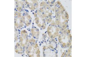 Immunohistochemistry of paraffin-embedded human stomach using GPT antibody. (ALT antibody  (AA 1-190))