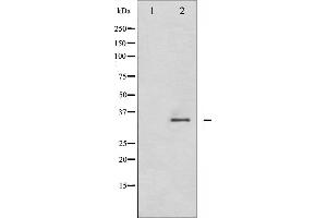 Western blot analysis of CDK2 phosphorylation expression in A2780 whole cell lysates,The lane on the left is treated with the antigen-specific peptide. (CDK2 antibody  (pThr160))