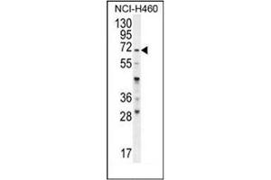 Western blot analysis of FUT4 Antibody (C-term) in NCI-H460 cell line lysates (35ug/lane).