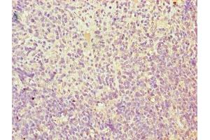 Immunohistochemistry of paraffin-embedded human thymus tissue using ABIN7173111 at dilution of 1:100