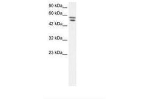 Image no. 1 for anti-Zinc Finger Protein 768 (ZNF768) (AA 57-106) antibody (ABIN202709) (ZNF768 antibody  (AA 57-106))