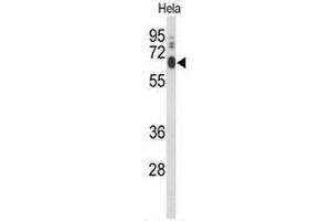 Western blot analysis of PCAT1 Antibody (C-term) in Hela cell line lysates (35µg/lane). (LPCAT1 antibody  (C-Term))