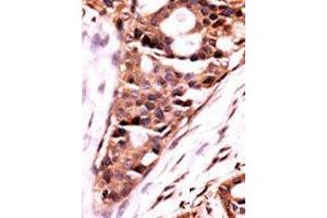 Image no. 2 for anti-Protein Phosphatase 3, Catalytic Subunit, beta Isozyme (PPP3CB) (N-Term) antibody (ABIN360810) (PPP3CB antibody  (N-Term))