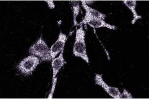 Immunofluorescence staining of RSV-3T3 cells. (MAP3K3 antibody  (AA 27-135))