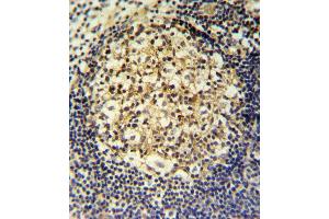 CCR7 Antibody (N-term) (ABIN651190 and ABIN2840119) IHC analysis in formalin fixed and paraffin embedded human tonsil followed by peroxidase conjugation of the secondary antibody and DAB staining. (CCR7 antibody  (N-Term))