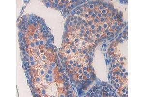 Used in DAB staining on fromalin fixed paraffin- embedded testis tissue (ABCA6 antibody  (AA 1398-1616))