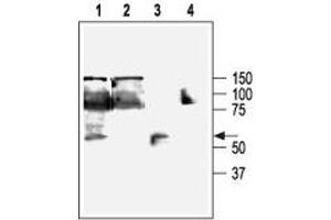 Western blot analysis of KCa3. (KCNN4 antibody  (C-Term, Intracellular))