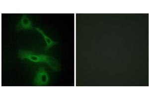 Immunofluorescence analysis of HeLa cells, using CLUS antibody. (Clusterin antibody  (C-Term))