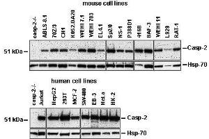 Western Blotting (WB) image for anti-Caspase 2, Apoptosis-Related Cysteine Peptidase (CASP2) antibody (ABIN187544) (Caspase 2 antibody)