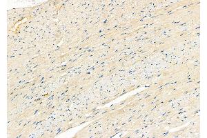 ABIN6266264 and ABIN6277421 at 1/100 staining Rat heart tissue by IHC-P.