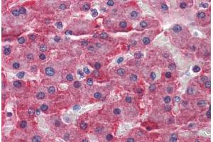 Human Liver: Formalin-Fixed, Paraffin-Embedded (FFPE) (CBS antibody  (AA 1-101))