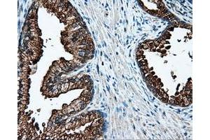 Immunohistochemical staining of paraffin-embedded Kidney tissue using anti-L1CAM mouse monoclonal antibody.