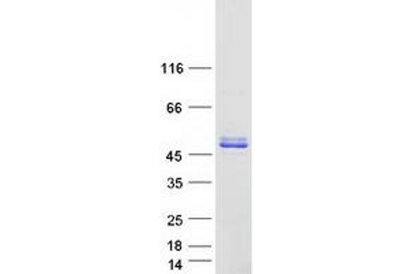 PRR5 Protein (Transcript Variant 2) (Myc-DYKDDDDK Tag)