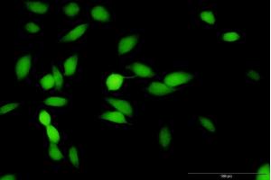 Immunofluorescence of purified MaxPab antibody to HMBS on HeLa cell. (HMBS antibody  (AA 1-361))