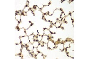 Immunohistochemistry of paraffin-embedded mouse lung using SULT2B1 antibody at dilution of 1:100 (x40 lens). (SULT2B1 antibody)