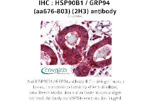 Image no. 3 for anti-Heat Shock Protein 90kDa beta (Grp94), Member 1 (HSP90B1) (AA 676-803) antibody (ABIN1723190)