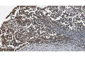 IHC analysis of MAP3K8 using anti-MAP3K8 antibody (ABIN4886663). (MAP3K8 antibody  (AA 9-193))