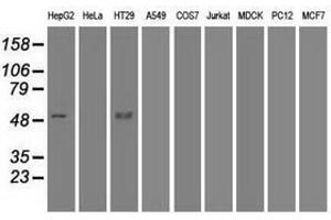 Image no. 6 for anti-serpin Peptidase Inhibitor, Clade A (Alpha-1 Antiproteinase, Antitrypsin), Member 1 (SERPINA1) antibody (ABIN1500874) (SERPINA1 antibody)