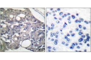 Immunohistochemistry (IHC) image for anti-Protein-tyrosine Phosphatase 1C (PTPN6) (AA 502-551), (pTyr536) antibody (ABIN1531195)
