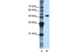 WB Suggested Anti-DDX47 Antibody Titration:  0.